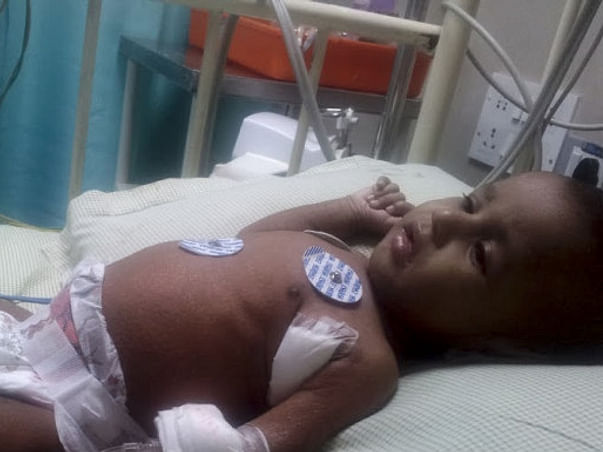 I am fundraising to save my 5 months old kid Venudev - Bone Marrow Transplantation treatment
