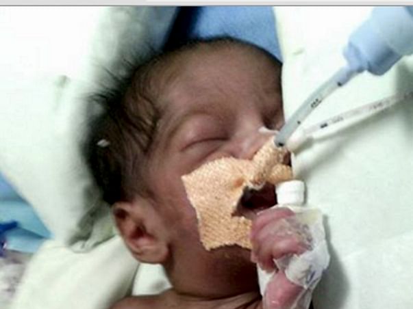 I am fundraising to Help Baby Vanshu get off the ventilator