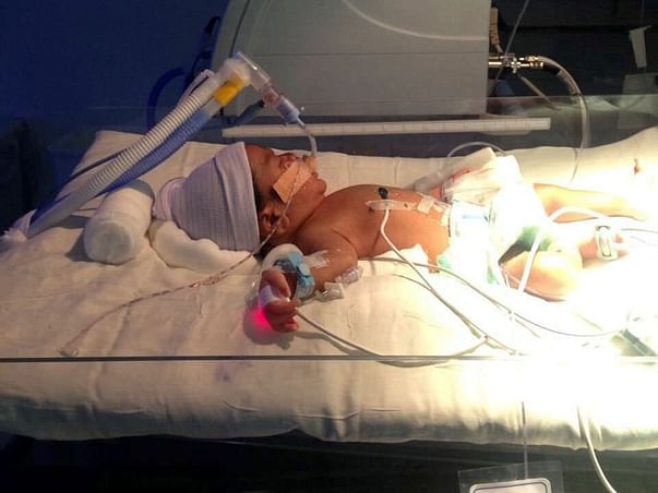 Help This 6-Day-Old Baby Stay Alive