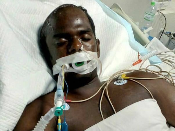 Severe head injury for my brother.He is in very critical stage.Help us