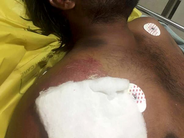 Save Naresh's life