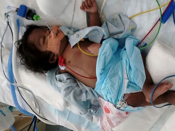 This 5-Month-Old Baby Needs Your Urgent Support To Stay Alive