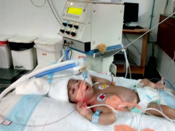 Help Baby of Chaya Fight a Lung Defect