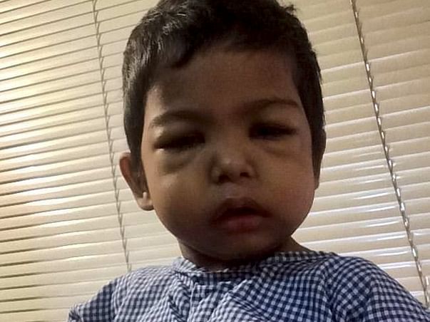 2yrs Baby Fighting with Liver Cell Failure