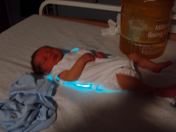 Help India fight Jaundice in Newborn