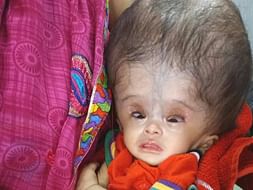 Support Diksha