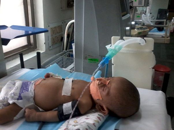 Help save baby Ghansham who's fighting against Shock& respiratory fail