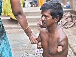 Feed the poor beggars and disabled destitutes