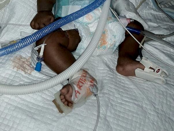 50 day Old kid with pneumonia needs money for treatment