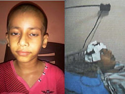 Support for little Jayesh Dangle suffering from NMDA ENCEPHALITIS WITH