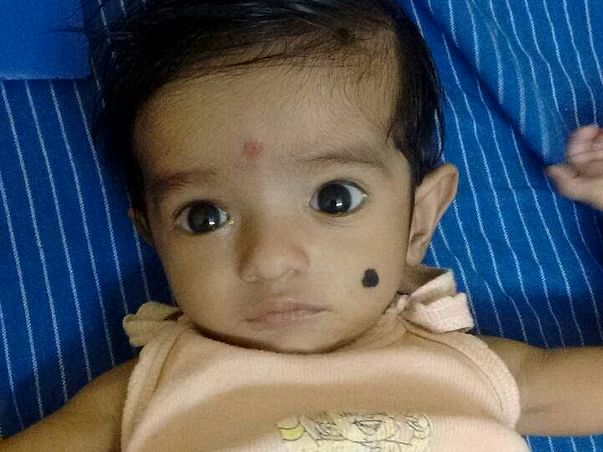 Need helping hands to save little baby boy