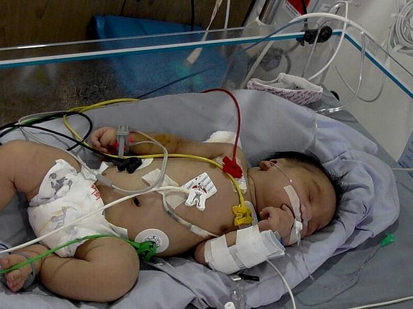 Help These Parents Save The Life Of Their New Born Baby