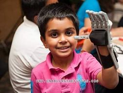 Lend a Hand to amputees - 3D printed Prosthetics