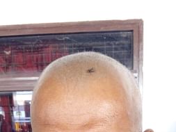 help for cancer patient