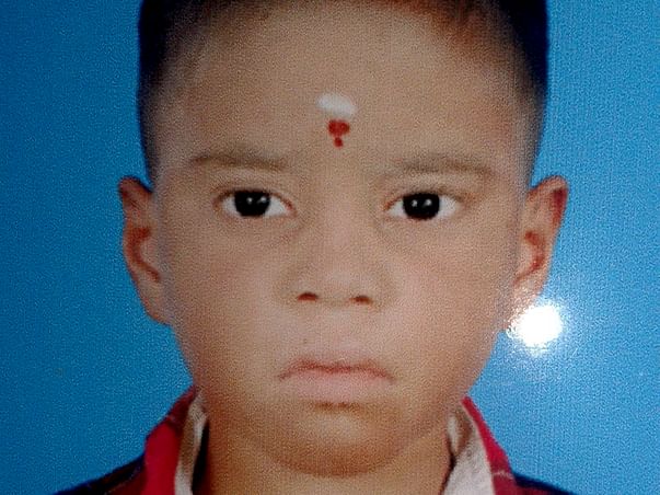 Need money to baby operation