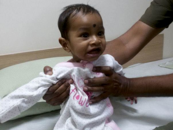 This 8-month-old Needs An Open Heart Surgery To Live