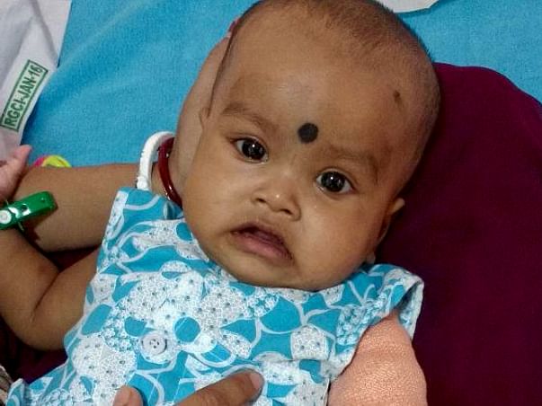 Help Us Buy 'Inj Blincyto' The Only Medicine That Can Save My Niece