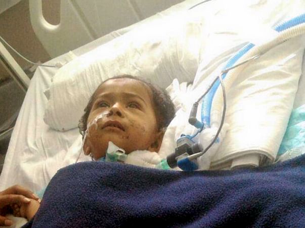 Help 15-Month-Old Mokshith Fight Pneumonia