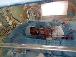 This Premature Baby Requires Your Support to Beat Death