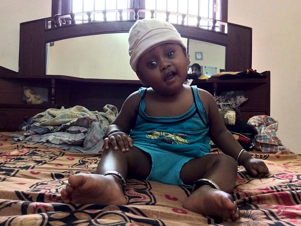 Baby Nidarshan Needs An Urgent Surgery To Replace His Skull