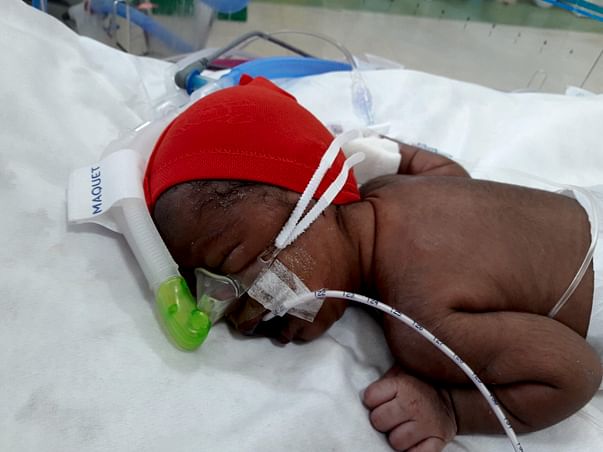 New Born Baby Needs Your Support To Live