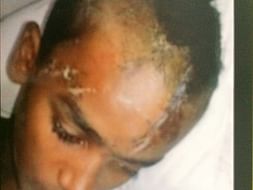 Operation and rehabilitation cost of Manobar Gajnavi'sleg
