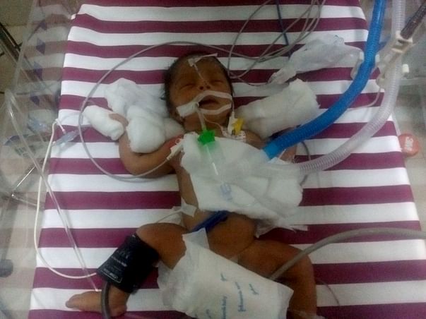 This Couple Needs Your Support To Save Their 3 Day-Old-Baby