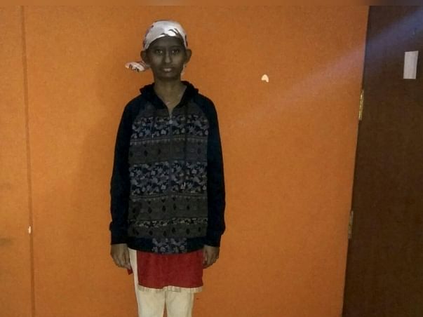 This 16-year-old Girl Won't Survive Brain Tumor Without Your Help