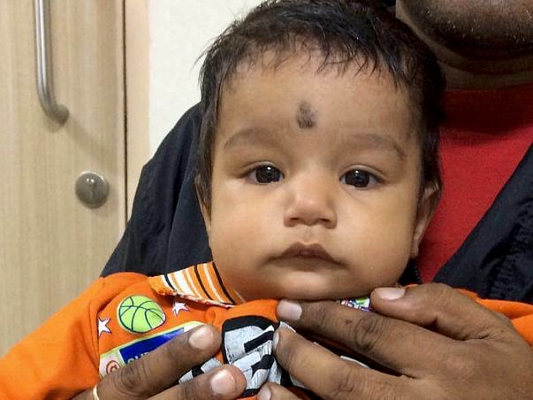 9-Month-Old Baby Needs An Urgent Heart Surgery