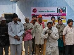 Help lepers in old Meerut Road, Hapur district of UP