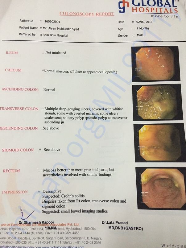 Colonoscopy Report