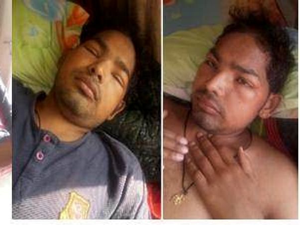 please help for my brother for kidney transplant