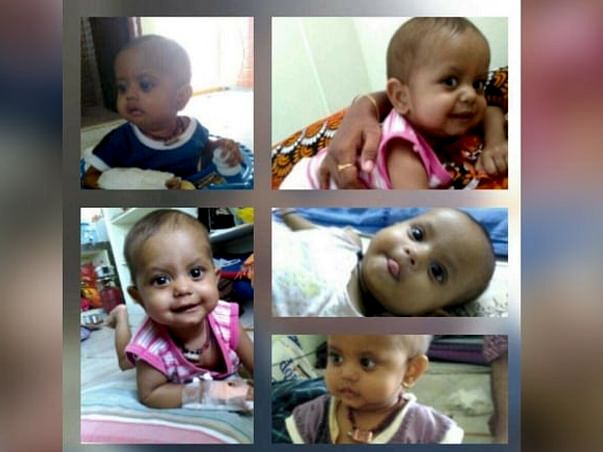 Help My 22-Month-Old Son Undergo A Bone Marrow Transplant