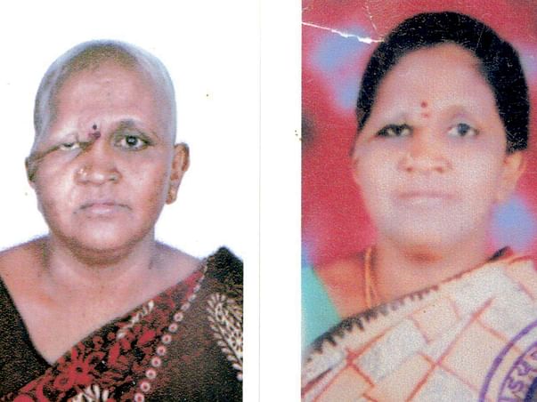 Rathna needs to undergo chemo to live for her 2 disabled daughters: