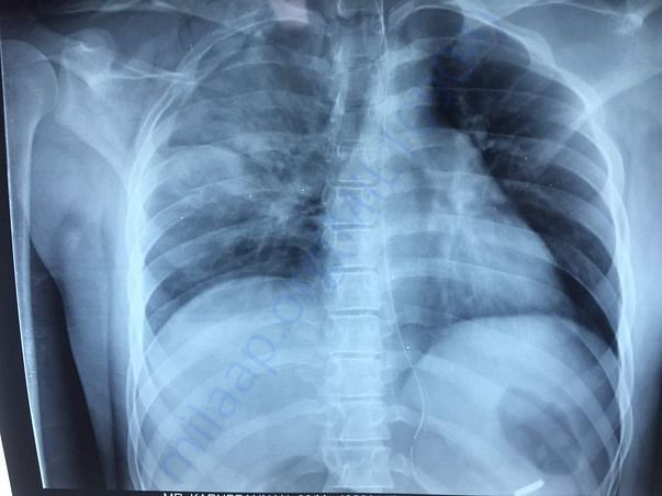 X ray reports