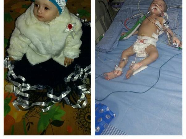 Help 1-Year-Old Inaya Naaz To Fight Pulmonology Edema