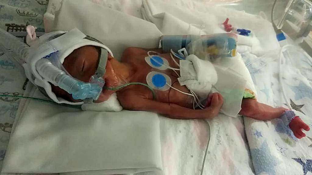 premature baby nicu