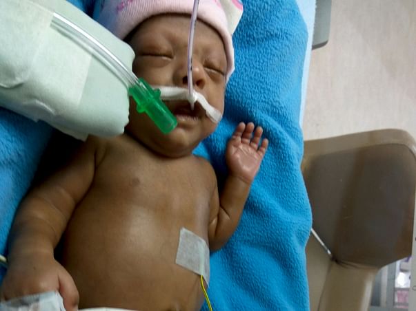 Help baby's Fight in NICU