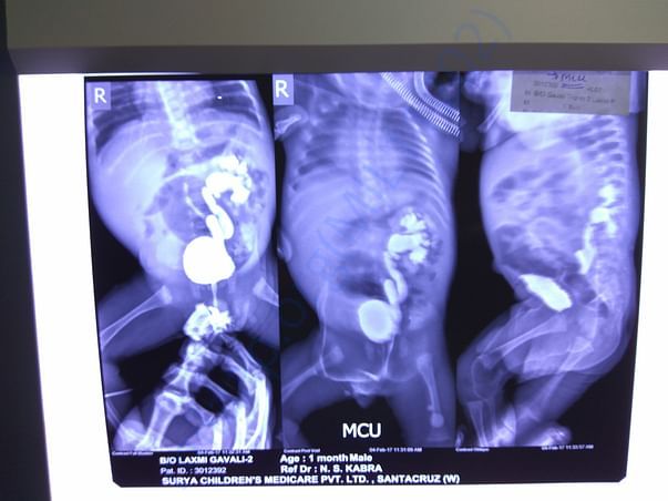 Triplet II X-Ray