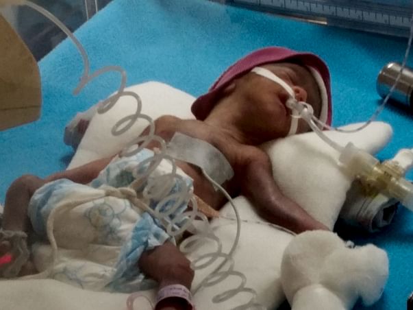 Help for extremely Premature baby