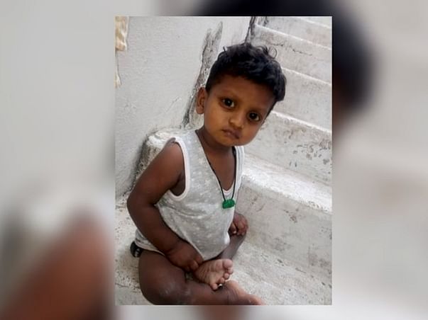 Save My 2-Year-Old Son From A Serious Liver Condition