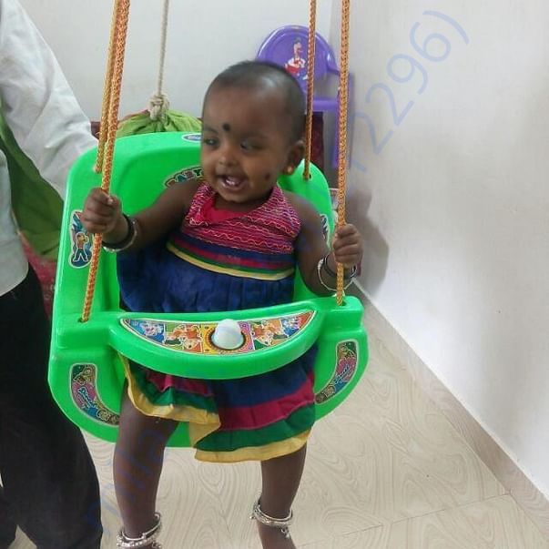 Baby Tanmayi before surgery
