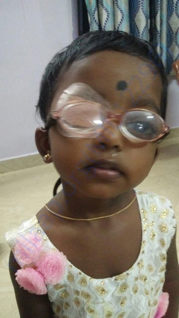 Baby Tanmayi in recovery