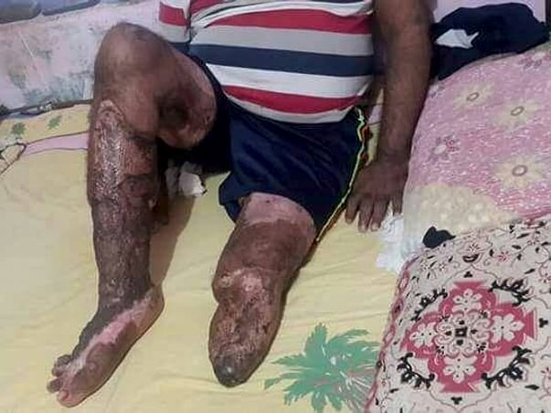 Help the Only Breadwinner of the Family Get Back On His Feet Again