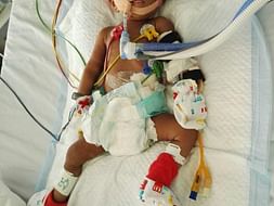 This 7-month-old baby is unable to Breathe