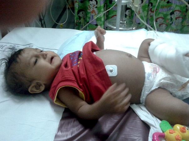 Save Burhanuddin, Liver transplant required