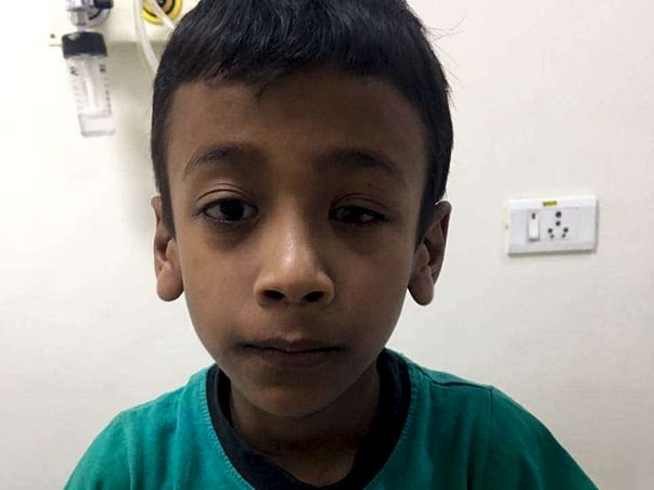 Help master Krishna get cochlear implant