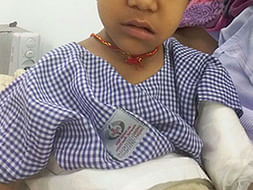 Support a Needy- Help Ravya for Her Bone Marrow Surgery