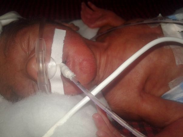 Help premature baby boy