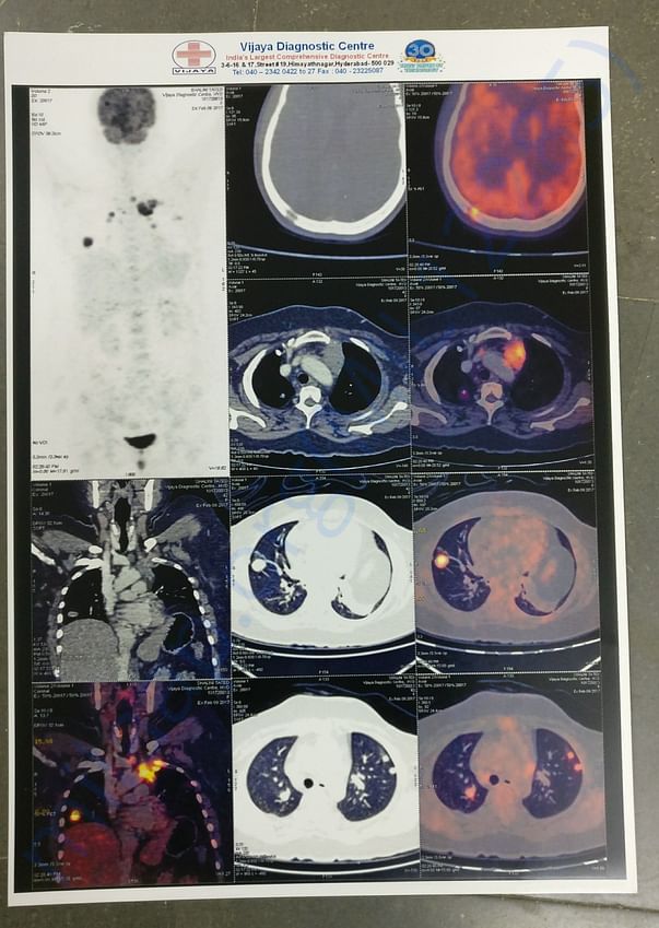 PET SCAN FILM